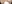 裏ハムラ法（経結膜的眼窩脂肪移動術） — プレジャー美容外科クリニック