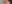 裏ハムラ法（経結膜的眼窩脂肪移動術） — ルアク美容外科クリニック