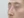 Nasal osteotomy (nasal bone narrowing) — before (7days) · The Ollim Plastic Surgery Clinic