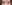 埋没法（二重埋没法） — クッキー美容外科クリニック