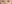 裏ハムラ法（経結膜的眼窩脂肪移動術） — プレジャー美容外科クリニック