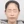 拉皮手術（筋膜拉皮／SMAS拉皮） — 術後 (10天) · AB 整形外科診所