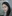ผ่าตัดแก้จมูกบาน (ลดขนาดปลายจมูก) — คลินิกเสริมความงามชาร์ป (Sharp)