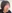 糸リフト（スレッドリフト） — ケイトクリニック