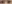 二重まぶた（自然癒着法） — デビビ美容外科クリニック