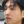 ฉีดลดขนาดจมูกแบบไม่ผ่าตัด (สลายไขมัน+สเตียรอยด์+โบท็อกซ์) — ก่อนทำ · คลินิก U