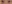 裏ハムラ法（経結膜的眼窩脂肪移動術） — ファクト美容外科クリニック