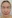 Ultherapy / Ulthera (อัลเทอร่า) — คลินิกเสริมความงามวูรี