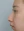 ผ่าตัดแก้ไขภาวะลิ้นจมูกตีบ/ยุบ (Nasal valve stenosis) — ก่อนทำ (30วัน) · ทีวายพลาสติกเซอร์เจอรี่