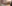 二の腕の脂肪吸引 — ドクターマンゴークリニック