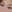 Partial incision double eyelid surgery — Yellow Plastic Surgery Clinic