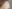 額縮小術（生え際下げ・ヘアライン下降術） — バタン美容外科クリニック