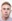 Lateral canthoplasty (outer corner opening) — Eight Plastic Surgery Clinic