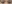 二重まぶた（自然癒着法） — プロミス美容外科クリニック