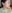Double chin liposuction (submental liposuction) — Il Gong Gong Plastic Surgery Clinic