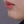 Full-face filler (full-face HA rejuvenation) — before · U&I Clinic - Yeongdeungpo Branch
