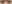 裏ハムラ法（経結膜的眼窩脂肪移動術） — ファクト美容外科クリニック