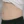 InMode Body (RF กระชับสัดส่วน/ลดไขมันลำตัว) — ก่อนทำ (28วัน) · เจฟิลคลินิก-สาขากังนัม