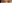眼瞼下垂手術（目つき矯正） — ジェスタ美容外科クリニック