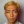 Ultracol (PDO microsphere collagen stimulator injection) — before (3days) · Project U Clinic