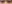 裏ハムラ法（経結膜的眼窩脂肪移動術） — オブジェ美容外科クリニック