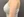 InMode Body (RF กระชับสัดส่วน/ลดไขมันลำตัว) — หลังทำ (30วัน) · คลินิก BAUS