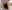 Breast augmentation with implants — Melon Plastic Surgery Clinic