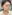 頬骨縮小術（全体／頬骨体部＋頬骨弓の骨切り） — ハイエンド美容外科クリニック
