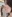 鼻尖形成術（自家軟骨移植） — メイドヨン美容外科クリニック