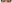 頬の脂肪吸引 — ファクト美容外科クリニック