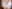 豊胸術（シリコンインプラント／人工乳腺） — エイト美容外科クリニック