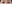 切開法（全切開法二重術） — IK美容外科クリニック
