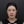 Thread lift — before · V&MJ Skin & Plastic Surgery Clinic