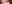 涙袋ヒアルロン酸注入（涙袋形成） — ヒューゴ美容外科クリニック