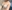 Hybrid breast augmentation (implant + fat grafting) — Eight Plastic Surgery Clinic