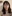 二重あごの脂肪吸引（顎下脂肪吸引） — ディユ美容外科クリニック