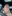 Aqua peel / hydro-dermabrasion (HydraFacial-type pore cleansing) — Galaxy Plastic Surgery Clinic