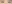 上眼瞼のたるみ取り（上眼瞼リフト・眉下切開） — ルホ美容外科クリニック
