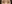 裏ハムラ法（経結膜的眼窩脂肪移動術） — アンド美容外科クリニック