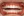 จัดฟันเฉพาะส่วนด้านใน 2D (2D lingual partial braces) — หลังทำ (120วัน) · โรงพยาบาล ID - ทันตกรรม