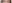二重まぶた（自然癒着法） — プロミス美容外科クリニック