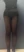 Buttock Liposuction — after (30days) · Line & View Clinic