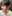 鼻尖形成術（自家軟骨移植） — ハイエンド美容外科クリニック