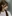 鼻尖形成術（自家軟骨移植） — アン美容外科クリニック