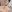 revision rhinoplasty — Coco Line Clinic