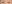二重まぶた（自然癒着法） — プロミス美容外科クリニック