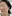リポットレーザー（しみ・老人性色素斑／脂漏性角化症の除去レーザー） — チャンドク韓方病院