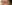 裏ハムラ法（経結膜的眼窩脂肪移動術） — ジャスト美容外科クリニック