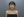 肩部填充（玻尿酸直角肩填充） — 术前 · AVA医美诊所