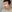 revision rhinoplasty — Anersty Plastic Surgery Clinic